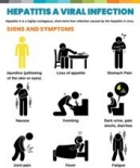 Hep A Symptoms Poster Hep A Symptoms Poster