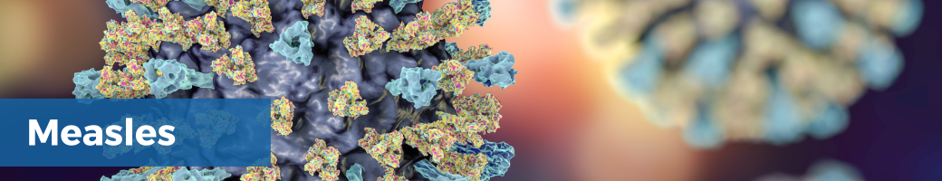 Measles Banner (webpage) (1040 × 200 px) - 2 Measles banner